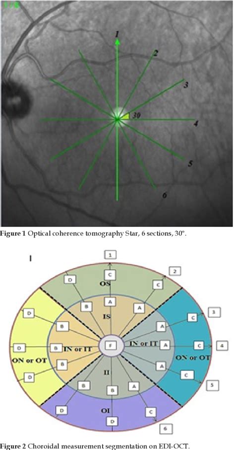 macular choroidal thickness measurement|choroidal thickness in adults.